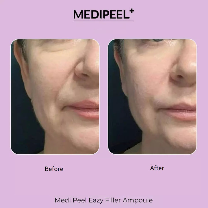 Medi-Peel Filler-Eazy Cream 50 ml