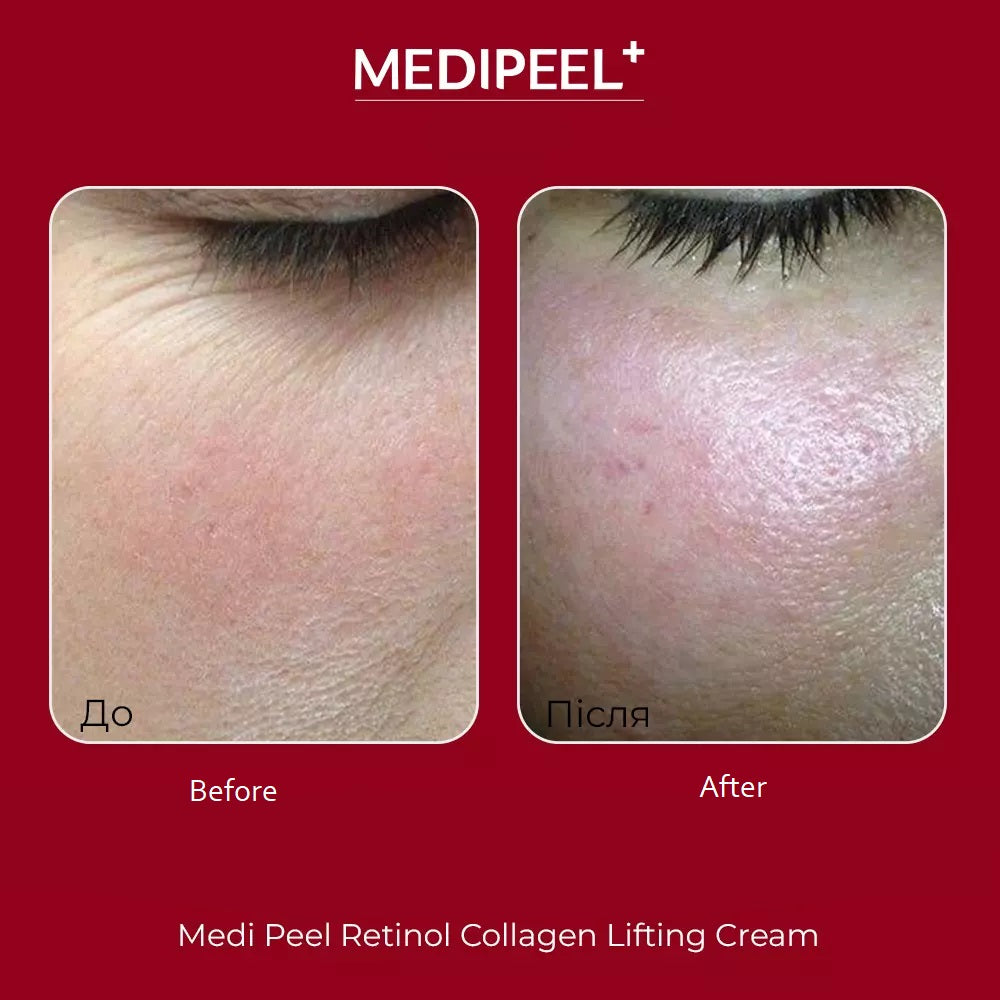 Medi-Peel Retinol Collagen Cream 50 ml