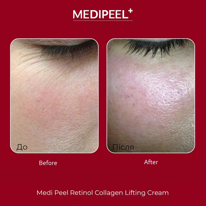 Medi-Peel Retinol Collagen Cream 50 ml