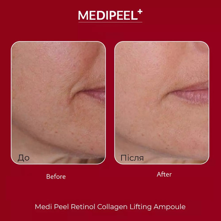 Medi-Peel Retinol Collagen Ampoule 50 ml